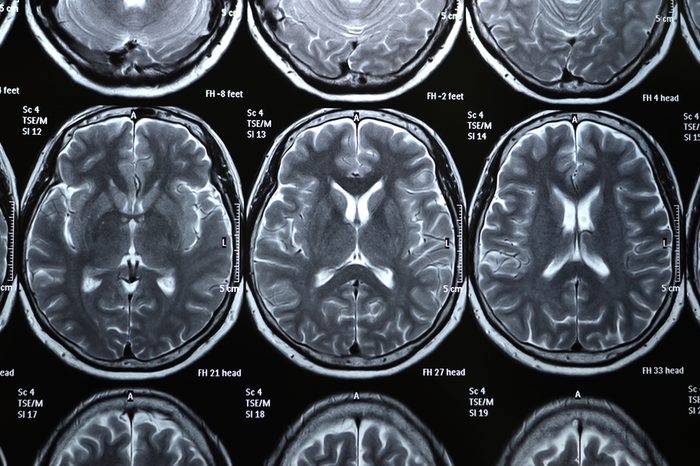 MRI Scaner Film