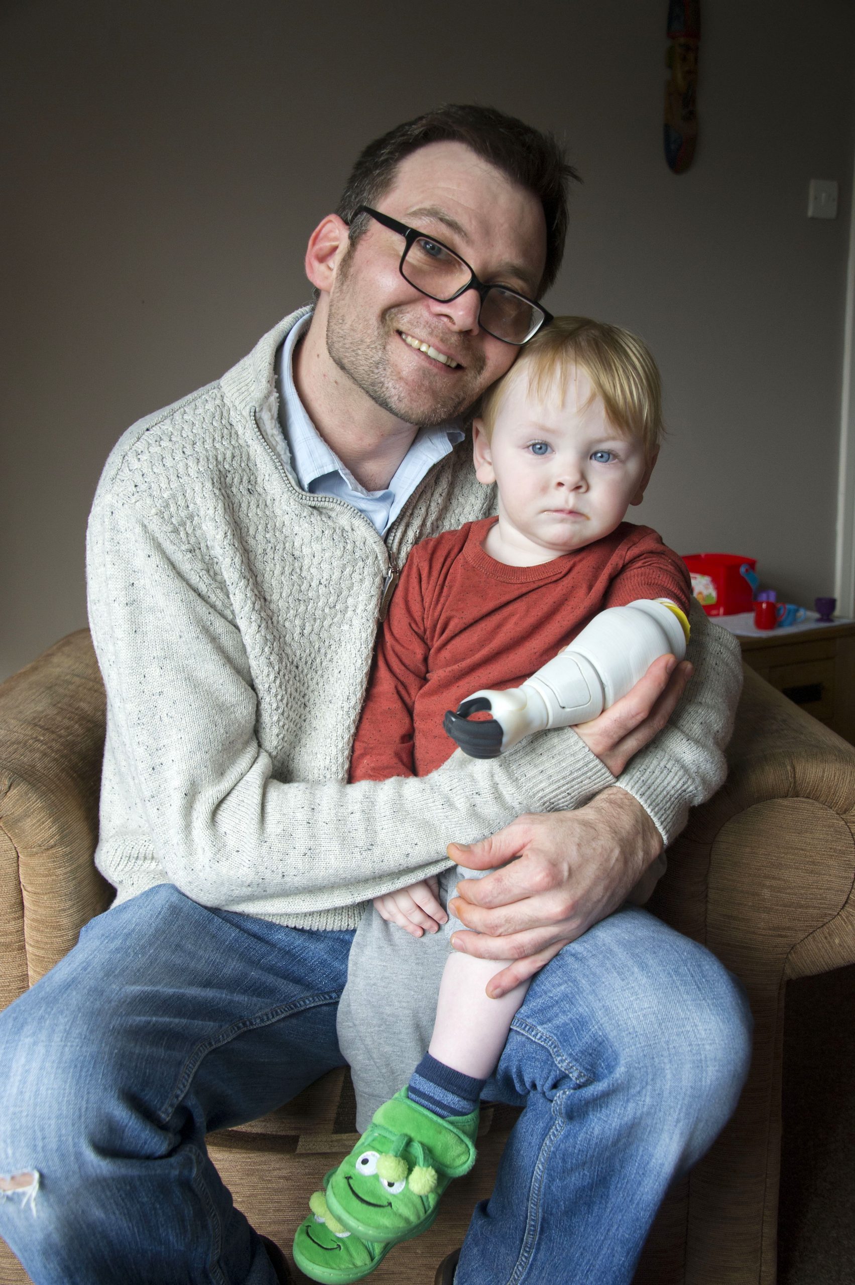 Father creates bionic prosthetic arm for baby son, Anglesey, Wales, UK - 01 Mar 2017